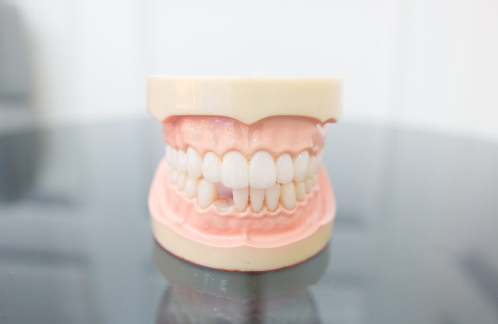 Close-up of mouth showing gap from a missing tooth representing need for tooth replacement